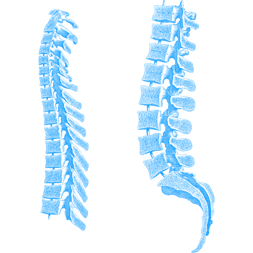 Pacemaker Implantation